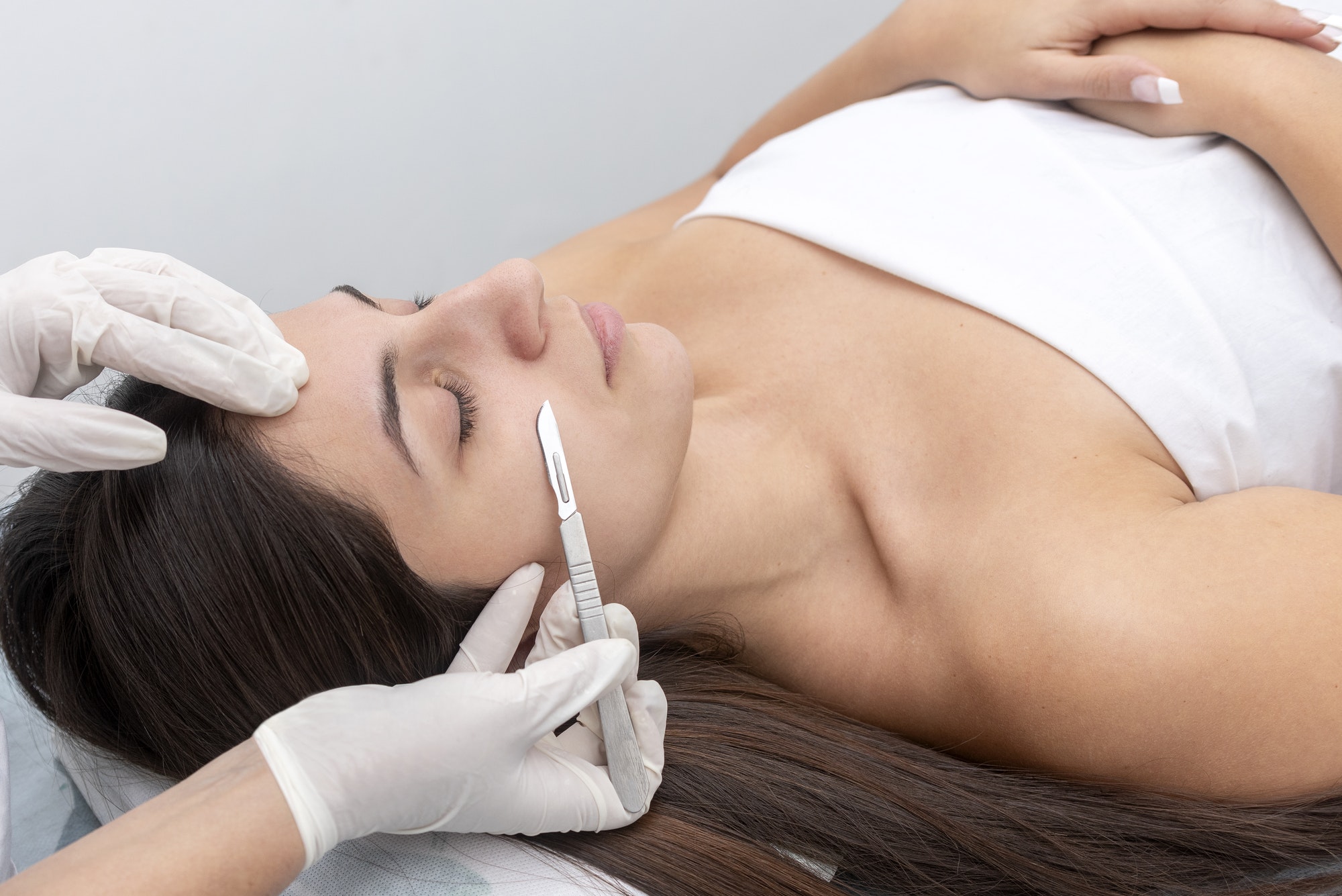Closeup of the doctor with a scalpel treating the woman's skin. Dermaplaning treatment.